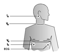 Electrode 
Placement Diagram